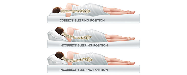 Sleeping Bad Posture is the cause of neck and back pain.jpg